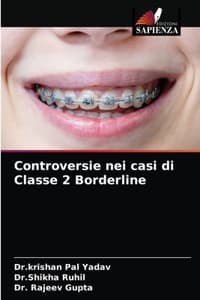 Controversie nei cas...