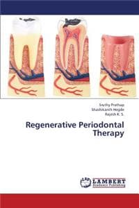 Regenerative Periodo...