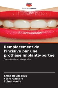 Remplacement de l'in...