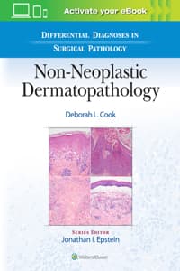 Differential Diagnos...